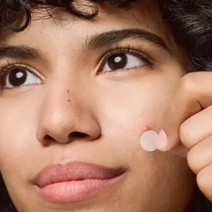 Parches para acné Flamenco, ideales para piel grasa